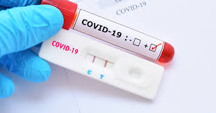 Covid-19. Mais 15 novos casos positivos aumenta total para 998 infeções