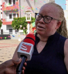 “Nunca me senti diferente por ser albina e apesar das minhas limitações vivo como uma pessoa ‘normal’” – empreendedora