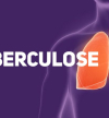 Dia Mundial da Tuberculose: Infecciologista aponta desistência dos pacientes do tratamento como desafio a vencer