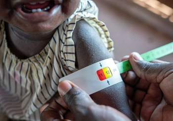 Inseguran&ccedil;a alimentar cresce no mundo e tende a agravar-se