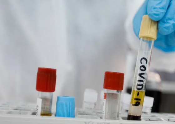 Covid-19. Cabo Verde prev&ecirc; receber cerca de 220 mil vacinas da Pfizer para 20% da popula&ccedil;&atilde;o