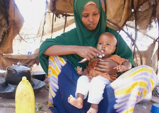 Som&aacute;lia: Cerca de 1,84 milh&atilde;o de crian&ccedil;as sofrem de m&aacute; nutri&ccedil;&atilde;o aguda