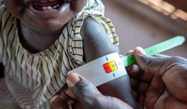 Inseguran&ccedil;a alimentar cresce no mundo e tende a agravar-se