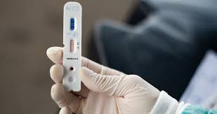 ERIS alerta para o cumprimento do preço máximo dos testes PCR